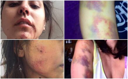 Joven modelo denuncia brutal golpiza por parte de guitarrista