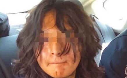 Presunto agresor de profesor de CCH Naucalpan es menor de edad; víctima se encuentra estable