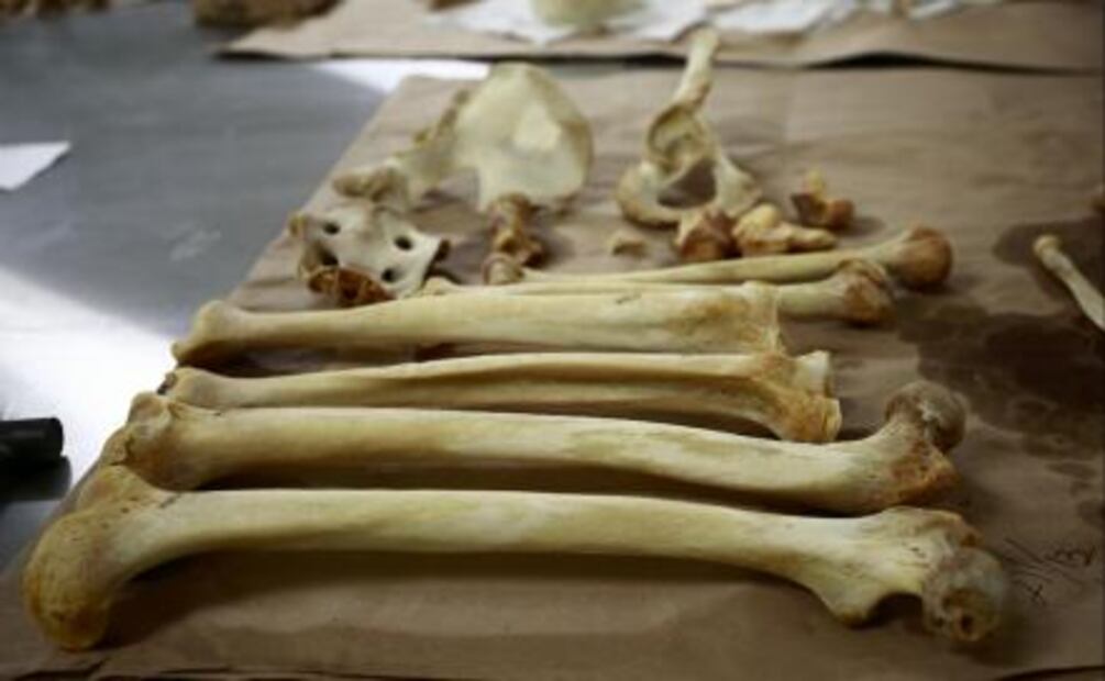Donar el cuerpo, una opción para salvar vidas después de la muerte