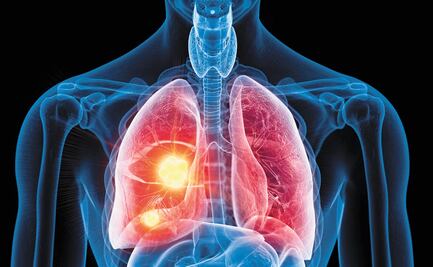 Los pulmones también albergan anticuerpos contra el Covid-19