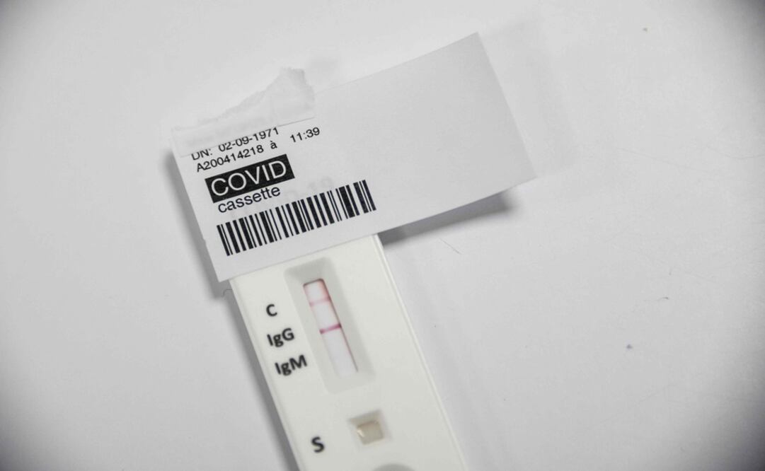 A positive COVID-19 serological test is pictured at a laboratory - Photo: Sebastien Bozon/AFP