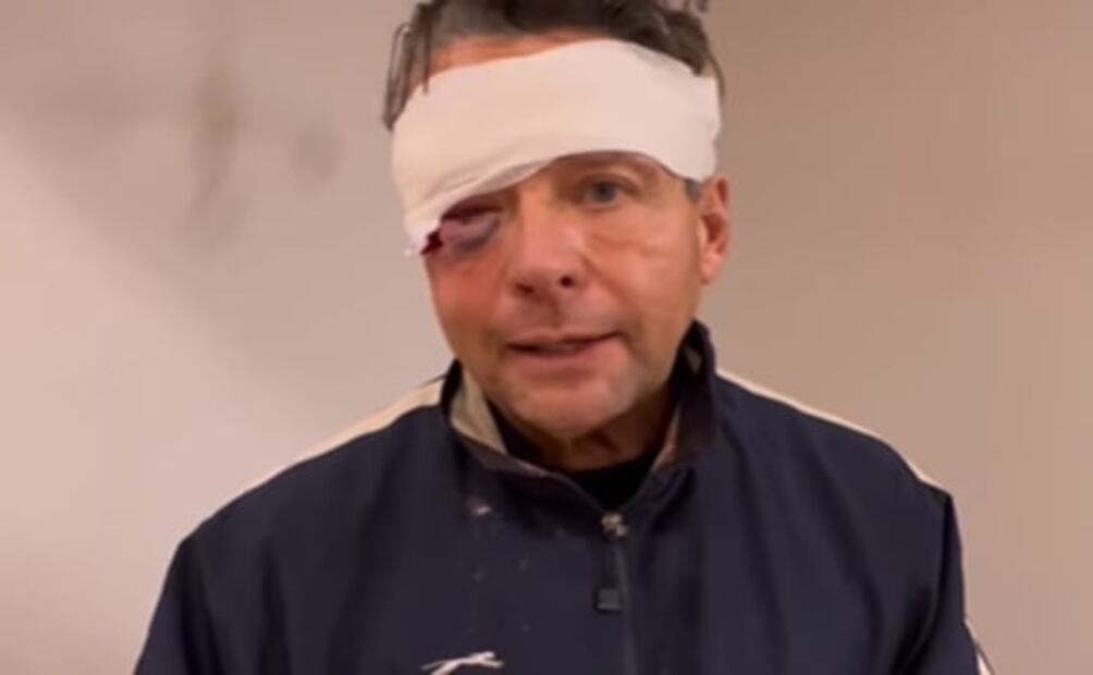 "Te pareces más que yo", le dice Alfredo Adame a Arath de la Torre por parodia