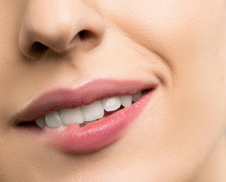 El hábito de morder o lamerse los labios puede hacer que empeoren. Foto: Pexels