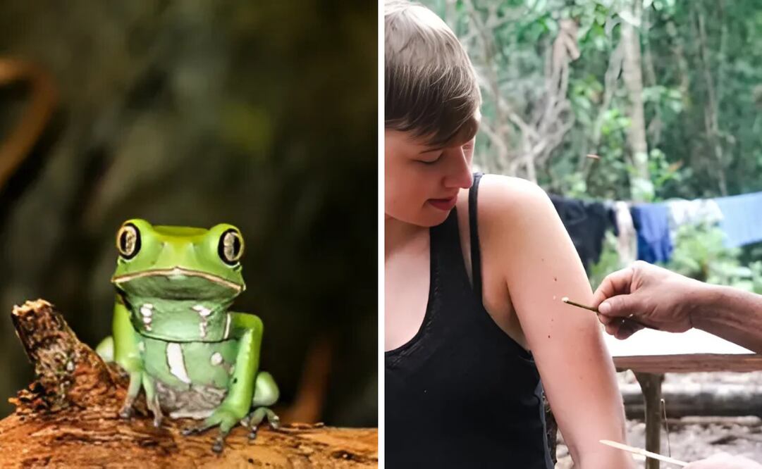 Las consecuencias del kambó.
Foto: Captura de pantalla