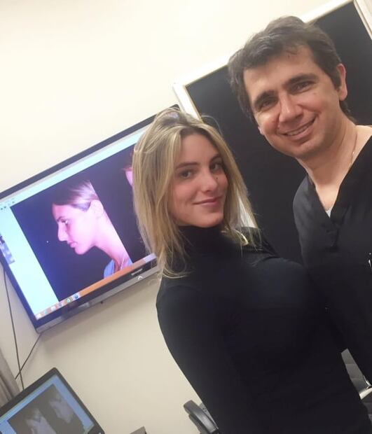 Lele Pons: esta es la cirugía que le cambió la vida a la sobrina de Chayanne