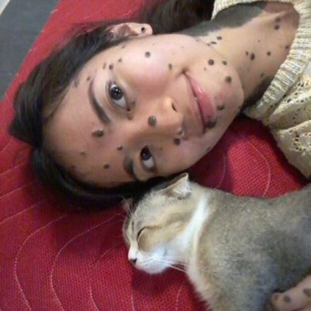 La modelo con lunares y verrugas que rompe esquemas