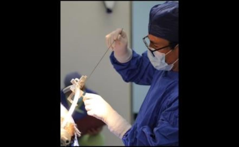 Realizan con éxito neurocirugía en paciente con Parkinson