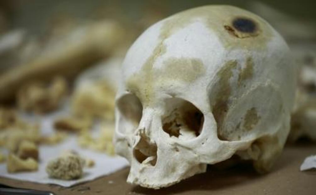 Donar el cuerpo, una opción para salvar vidas después de la muerte