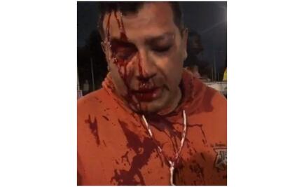 CDH condena agresiones a reporteros de TV Azteca y Reforma en la Doctores