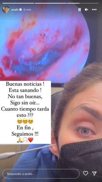 Anahí actualiza a sus seguidores sobre la salud de su oído.