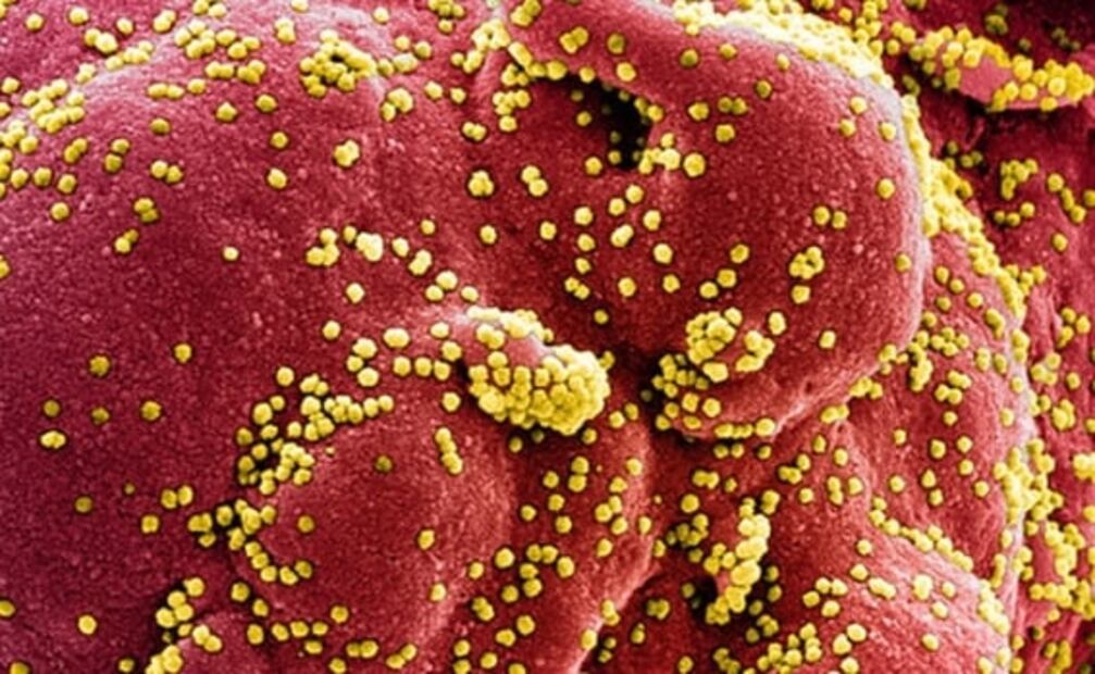 Aspirina reduce riesgo de infección del Covid-19, según estudio