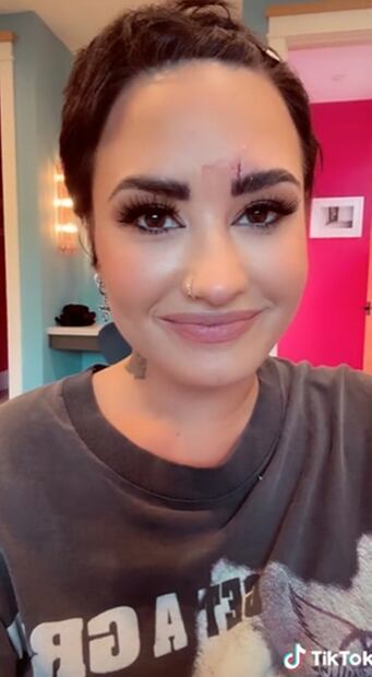 Demi Lovato sufre aparatoso accidente y lo comparte en redes sociales