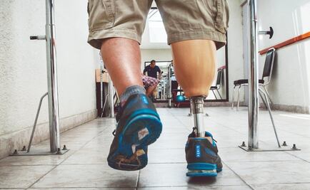 Desarrollan prótesis de pie y tobillo de bajo costo en Jalisco