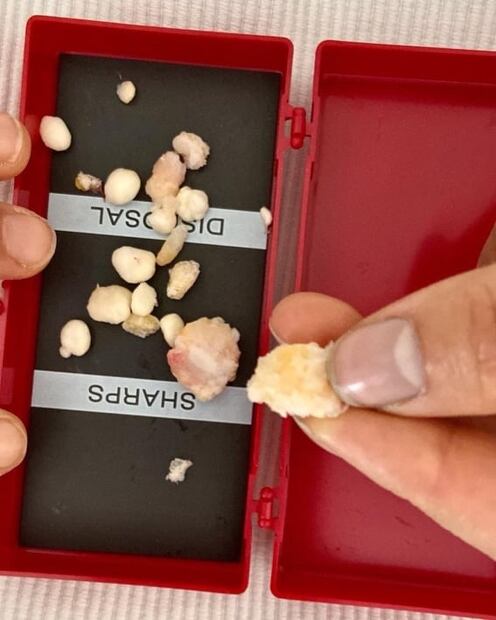 Alexa Moreno comparte en redes las "bellas creaciones óseas" que le quitaron de los pies