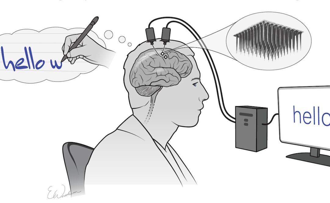 Está siendo probado por investigadores de la Universidad de Stanford.