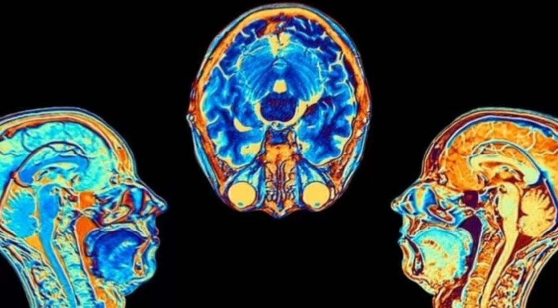 ¿Cuáles son los virus que permanecen escondidos en el cuerpo y rebrotan décadas después?