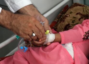 Combinación de dos virus pudo provocar casos de hepatitis infantil aguda