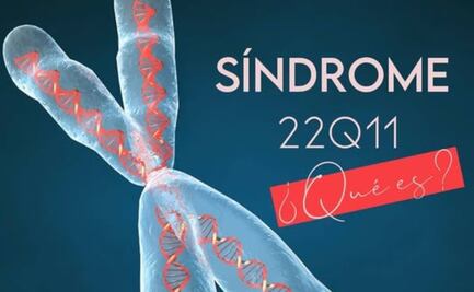 ¿Qué es el Síndrome 22q11? Conoce sus principales características