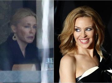 ¿Qué le pasó al rostro de Kylie Minogue?