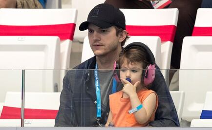 Ashton Kutcher sufre pérdida de cabello