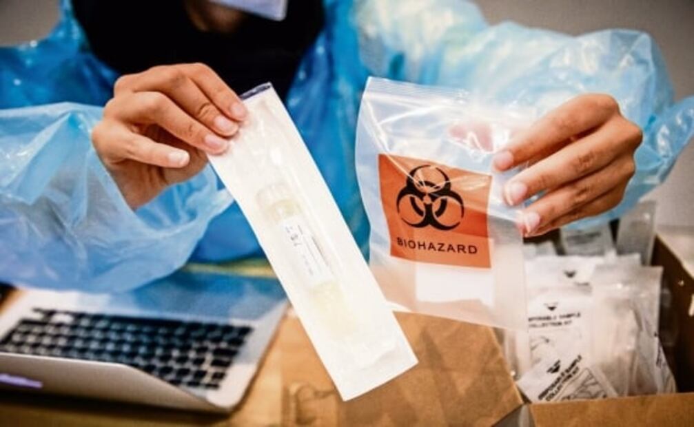 Covid-19. ¿Cómo funciona la prueba de antígenos para detectar el Covid-19?