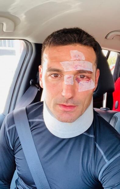 Atropellan al técnico de la Selección de Argentina