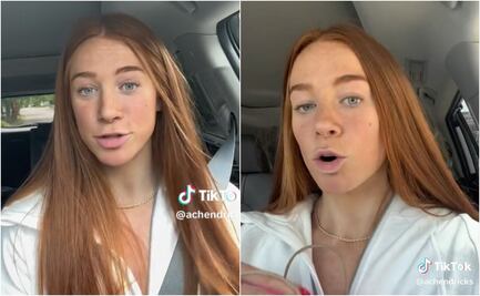 Joven revela que tuvo una semilla en su mejilla durante semanas y revolucionó TikTok