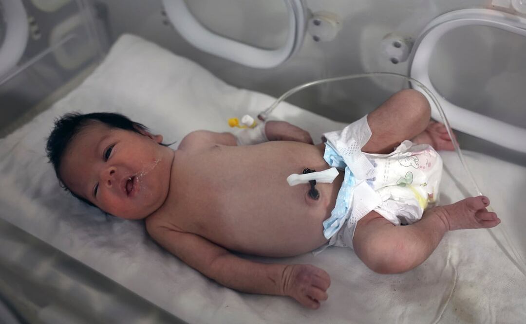 Una niña que nació bajo los escombros causados ​​por un terremoto que sacudió Siria y Turquía recibe tratamiento dentro de una incubadora en un hospital infantil en la ciudad de Afrin. Foto: AP 
