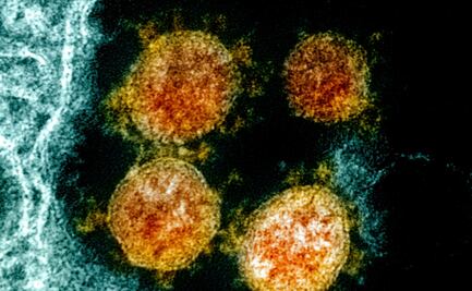 Genes neandertales pueden aumentar riesgo de Covid-19 grave: estudio