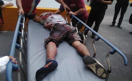 Balean a dos hombres afuera de su casa en Ixtapaluca 