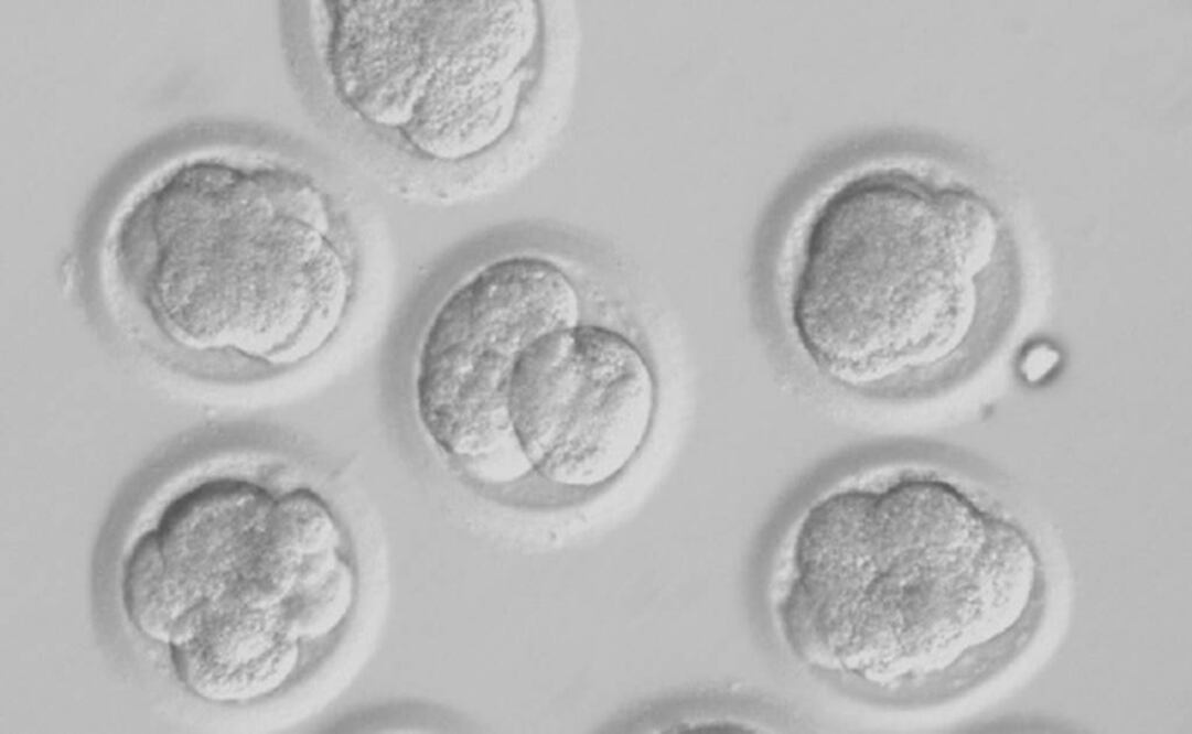 La biopsia se realiza en una glándula de la parte trasera de la boca y detecta la acumulación de una proteína presente en las neuronas de las personas con Parkinson. Foto: Archivo