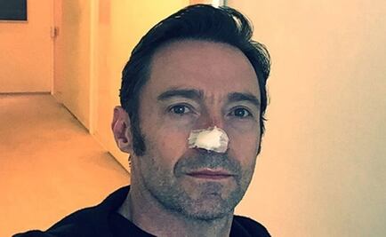 Hugh Jackman de nueva cuenta recibe tratamiento contra cáncer