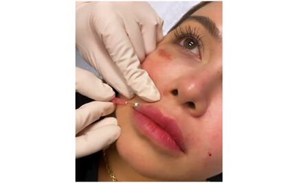 Chiquis Rivera se inyecta los labios y lo transmite en Instagram 