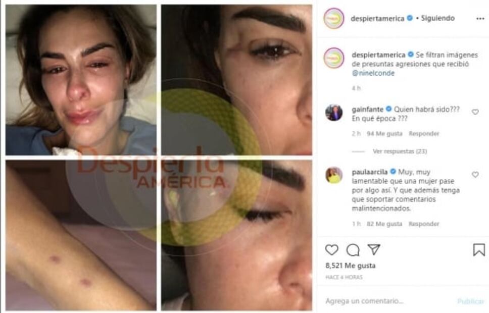 Ninel Conde denuncia a su expareja Giovanni Medina por violencia