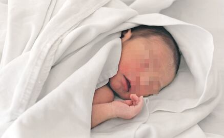 Colocan con éxito marcapasos a recién nacida en Edomex