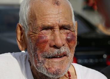 American woman gets 15 years for hitting 91-year-old Mexican with a brick
