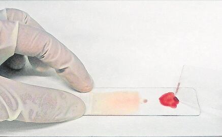 El virus de la malaria, un reto para la ciencia