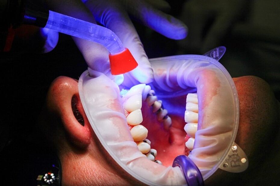 Turismo Dental. Foto: Pixabay