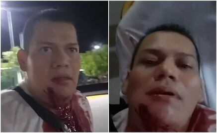 "Me pegaron, ¡ayúdenme!": balean a activista que criticaba inseguridad en Apatzingán; transmite en vivo aún herido