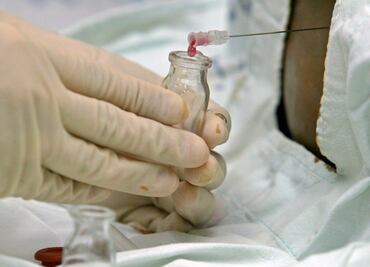 Con sangre de cordón umbilical curan a paciente con VIH