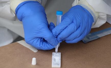 OPS trabaja en prueba que detecte a la vez Covid-19 y gripe