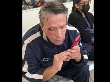 Golpean a Alfredo Adame por intentar grabar a dos personas baleadas en Tlalpan; hay dos detenidos