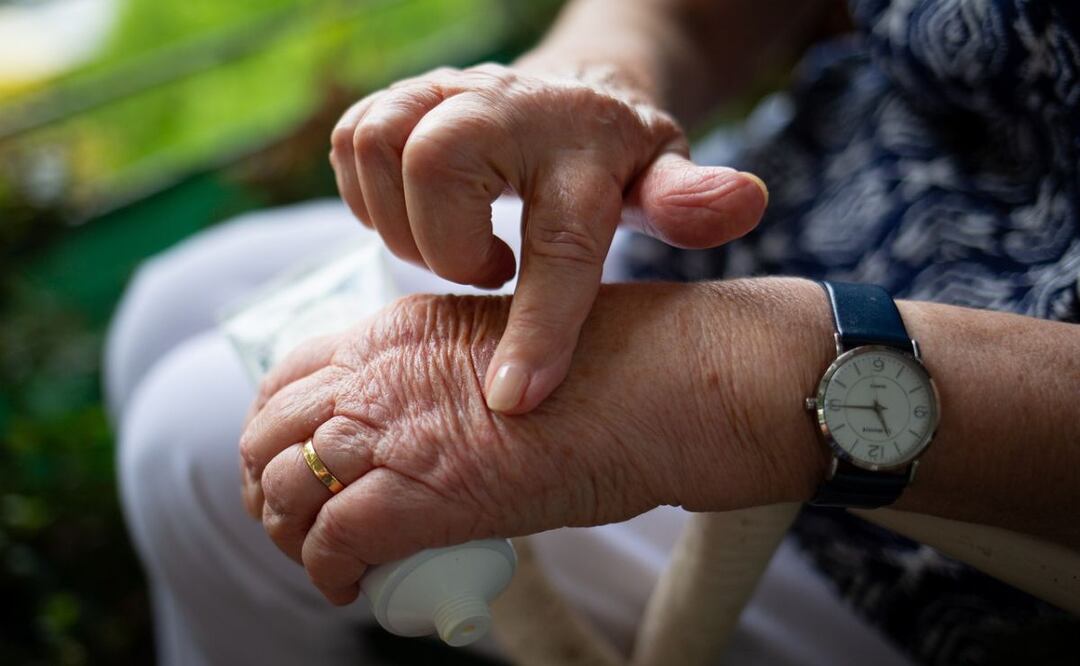 Orégano contra la artrosis. Fuente: Pixabay