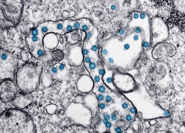 Covid-19. Crean potente antiviral procedente de las llamas contra el coronavirus