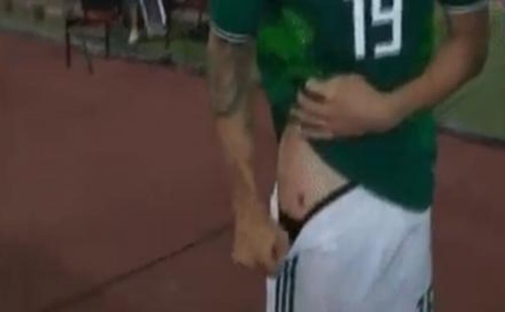 Layún muestra su herida del juego ante Argentina