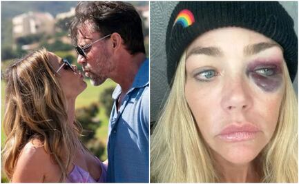 Denise Richards, ex de Charlie Sheen, denuncia agresiones de su esposo, el actor Aaron Phypers; obtiene orden de alejamiento
