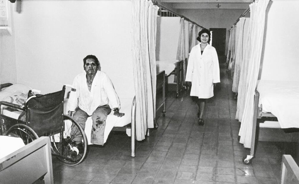 Paciente “lazarino” en un leprosario mexicano, en los años 80, mostrando varias lesiones cutáneas. El severo avance de la enfermedad provoca pérdida de extremidades, como se muestra en la imagen. Foto: Vicente Arteaga/Archivo EL UNIVERSAL.