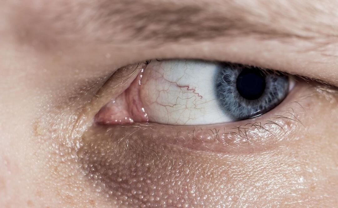 Cofepris recomienda no adquirir Lumigan (bimatoprost) solución 0.03% con los números de lote y fechas de vencimiento antes mencionados para el glaucoma. Fuente: Pixabay