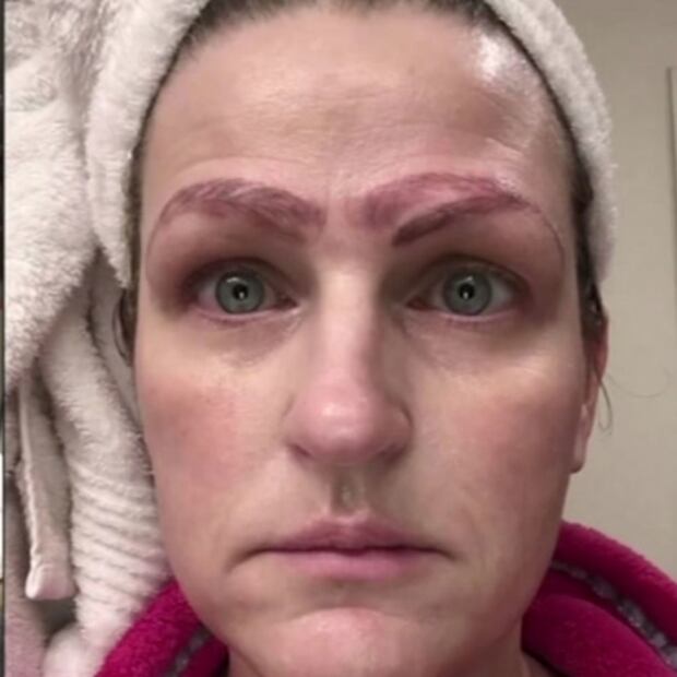 Mujer se hace microblading y le dibujan cuatro cejas