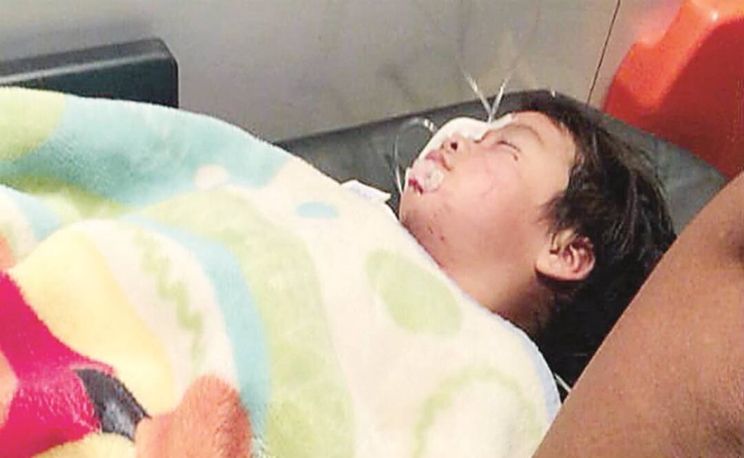 Alan, de seis años, presuntamente se acercó a acariciar a un perro de su vecina cuando este estaba dormido y el animal lo mordió hiriéndole un ojo (ESPECIAL)